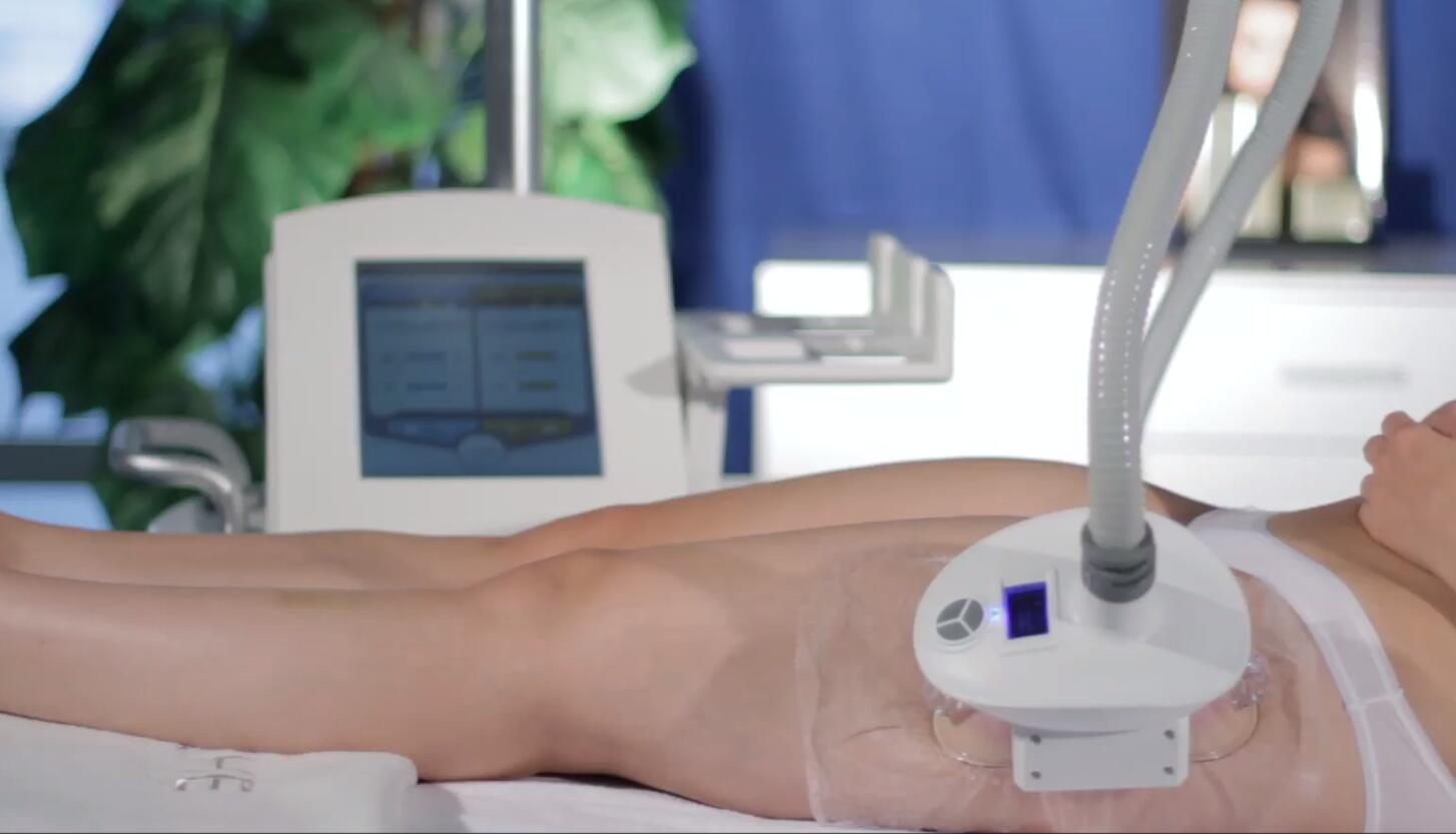 Practical applications of cryolipolysis machines.