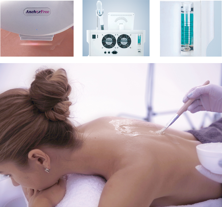 Application of IPL hair removal machine of anchorfreetech.