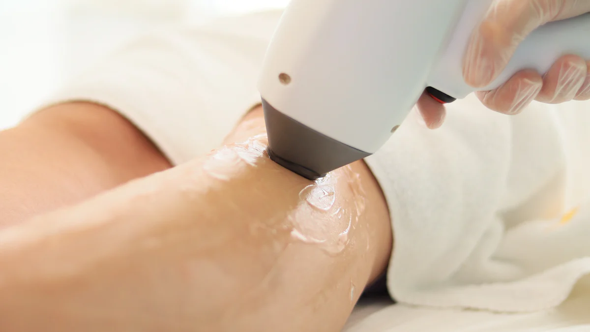 Exploring the Principles of Laser Hair Removal and Its Impact