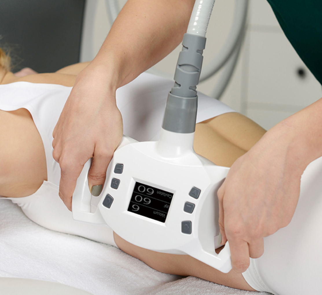 Cryolipolysis Machine Exploring the Science Behind Adipocyte Freezing