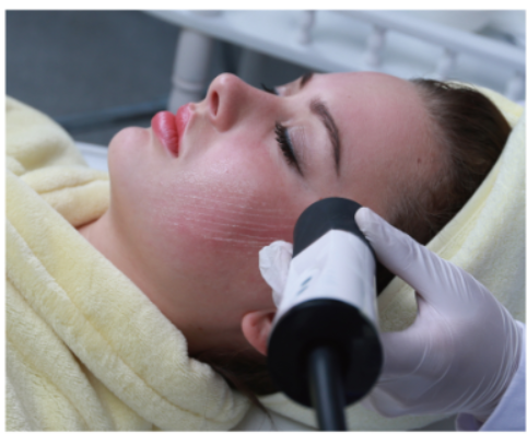 Beauty Revolution Decoding How Radio Frequency Machines Transform Skin