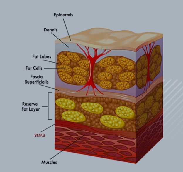 RF Therapy